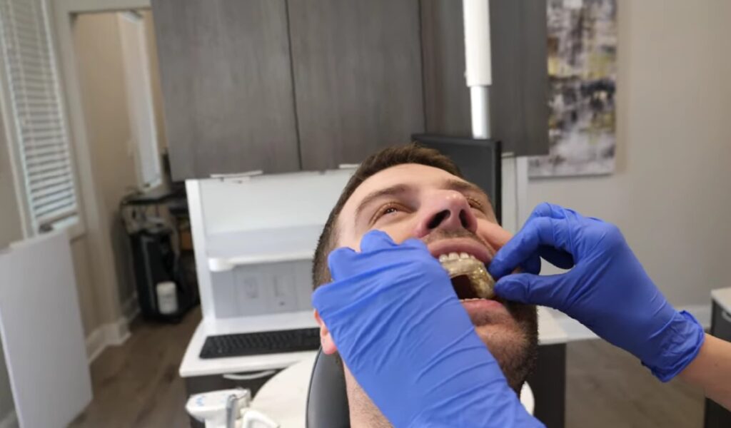 how to clean mouth guards